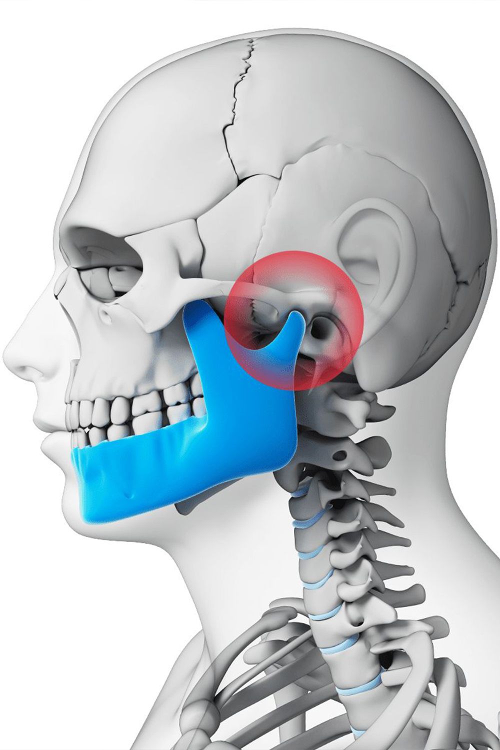 TMJ Treatment